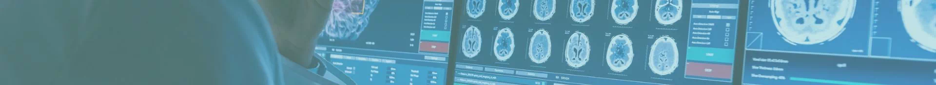 skany mózgu wyświetlane na monitorach