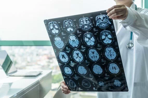skan mózgu badany przez dwóch lekarzy